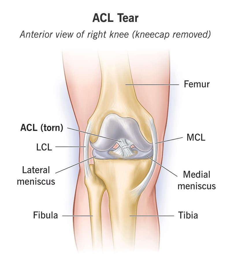 Robotic Knee Replacement in India